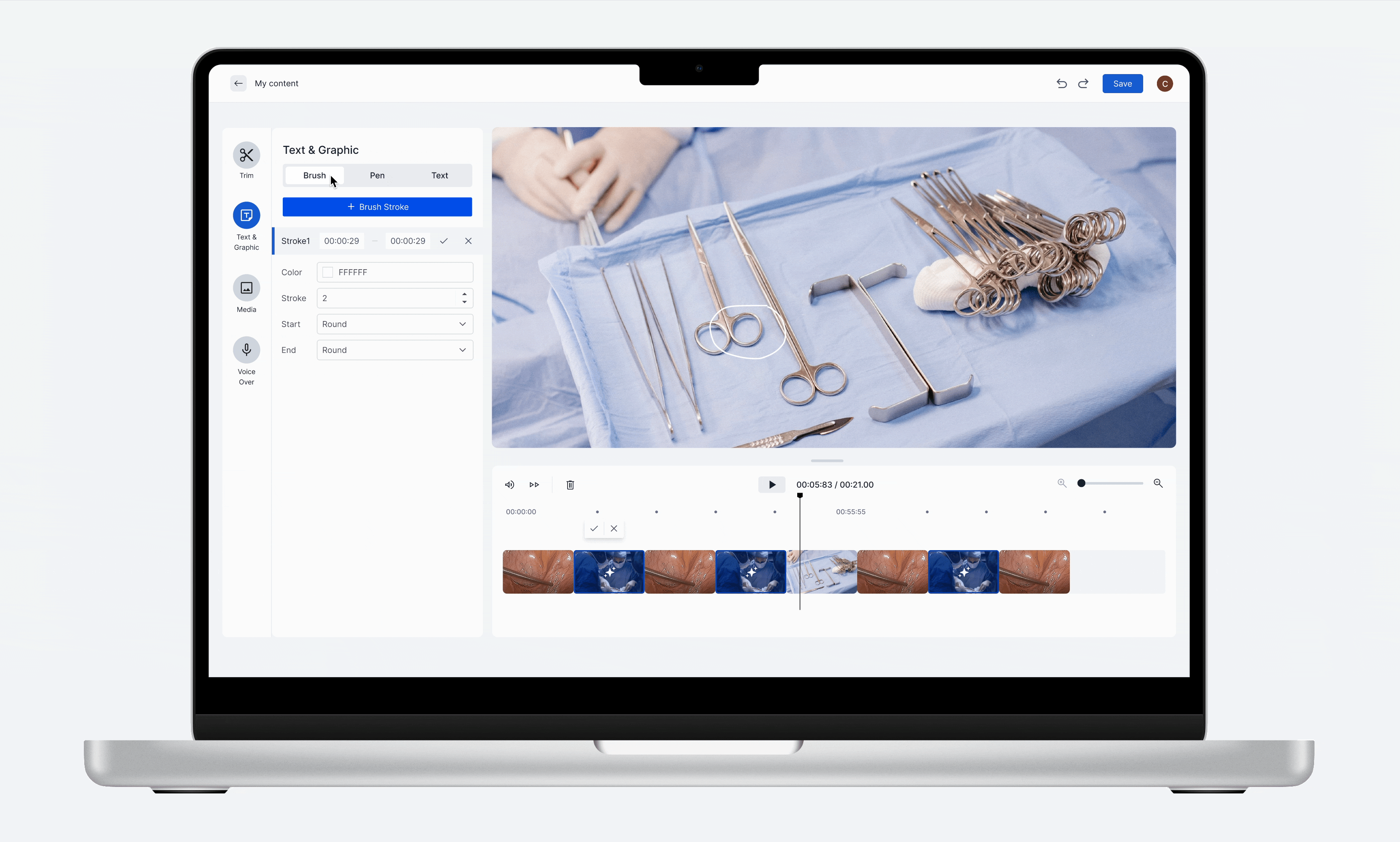AI-assisted editor